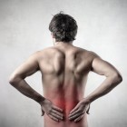 Sciatica