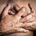 Costochondritis – A Benign Cause of Chest Pain