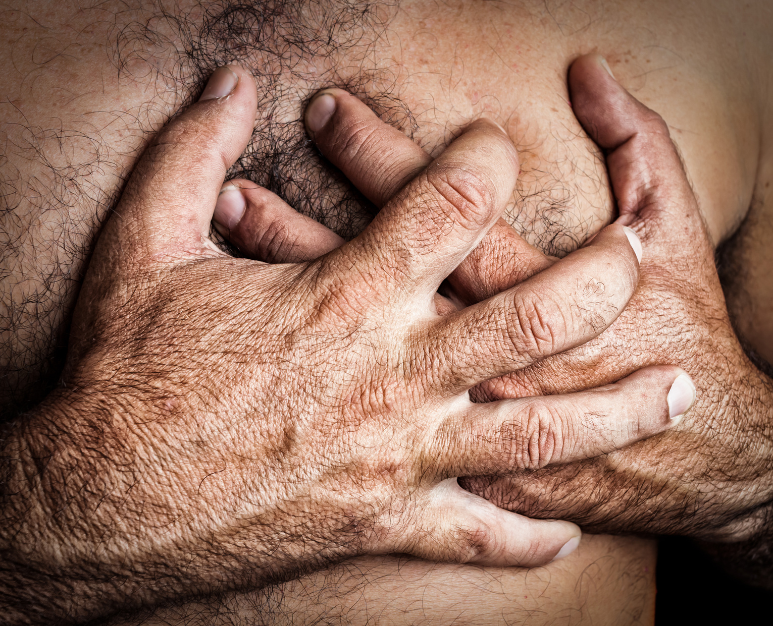 Costochondritis – A Benign Cause of Chest Pain