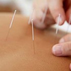 Medical Acupuncture